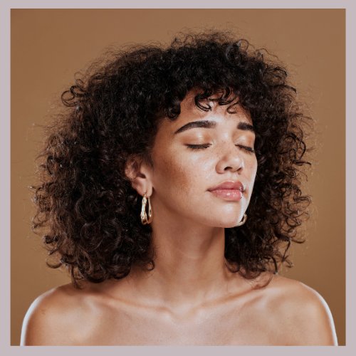 melasma